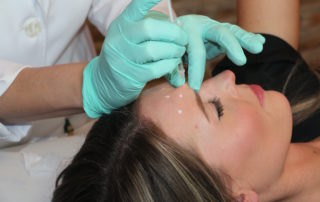 Botox procedure at Lapiel Laser Center in Chicago, IL