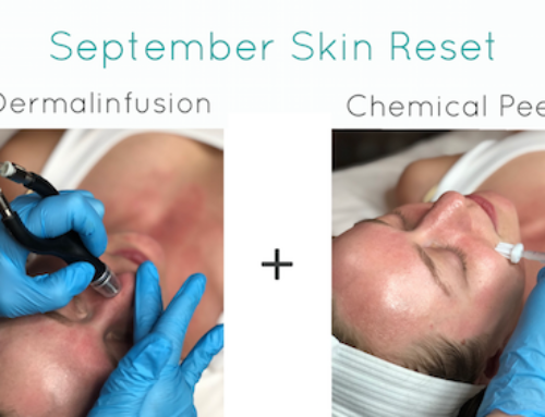 September Specials Are All About The Peels