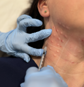 Chicago Neck Botox Treatment