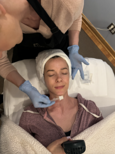 Chemical Peel Chicago