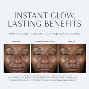 Best Facial In Chicago