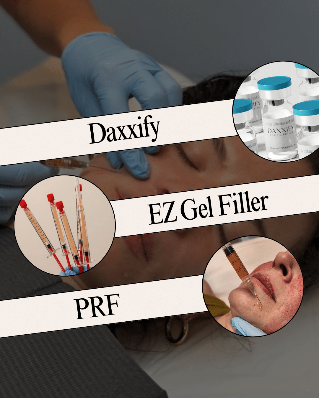 Chicago Biostimulator and EZ Gel Filler