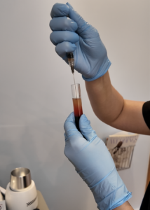 PRF + Microneedling Chicago