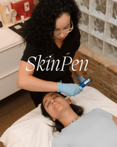 Chicago Acne scar treatment 